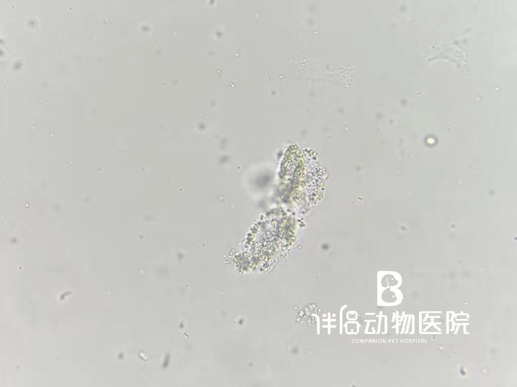 颗粒管型是含有颗粒的透明管型
