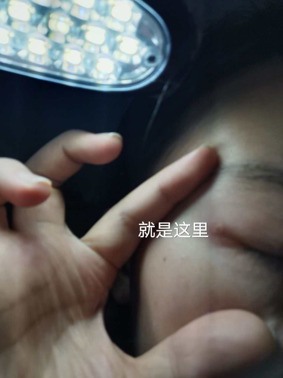 怎么回事 昨天早上起来就感觉眼角痛,一起来看就红了,摸上去就疼,准备