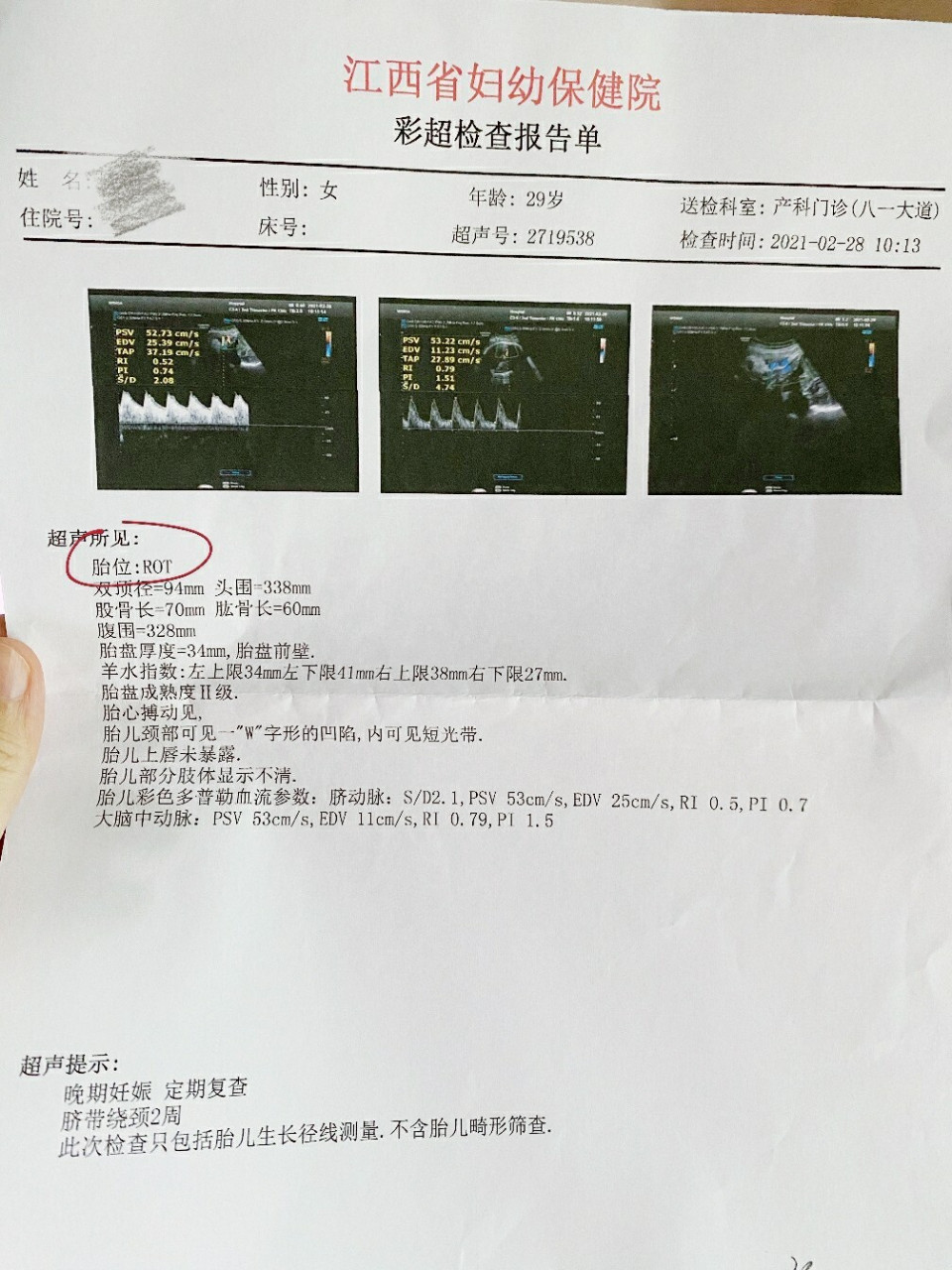 95孕34周臀位,孕36周寶寶自己轉成頭位75 本來36周的時候就想分享