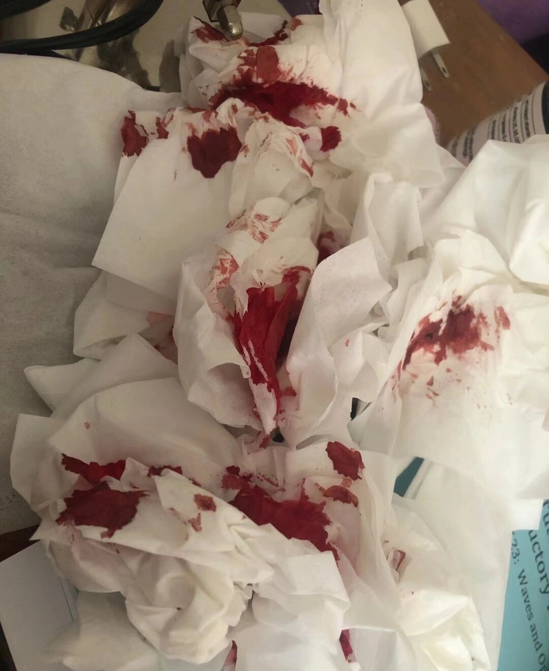 流鼻血了,图片来自知乎