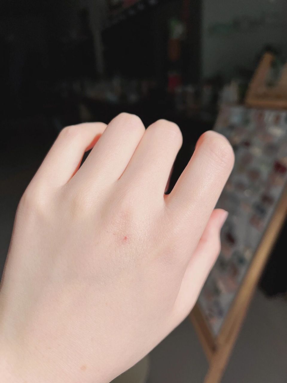 手上为啥会有这种小红点?