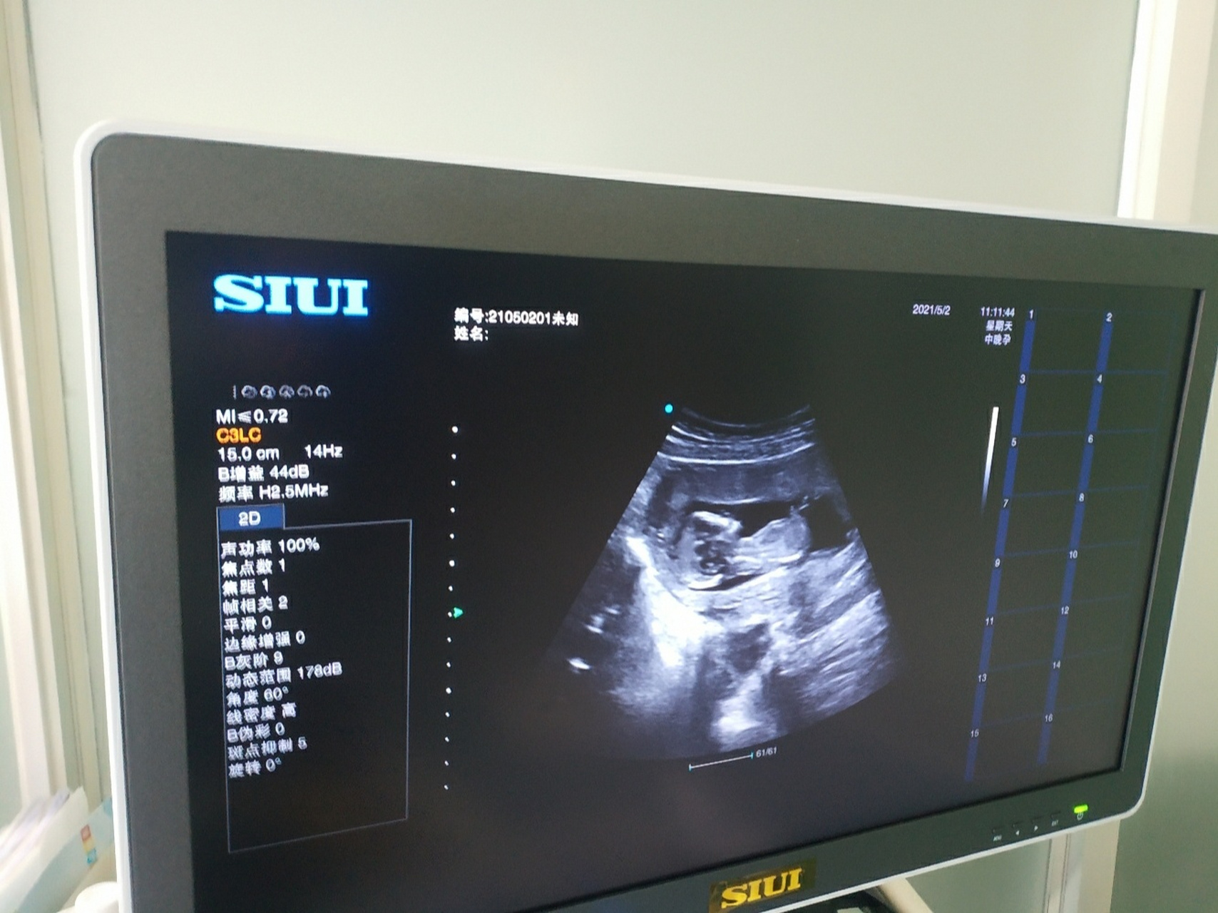 帮忙看一下是脐带还是小鸡? 现在是14 5天,想接女鹅.