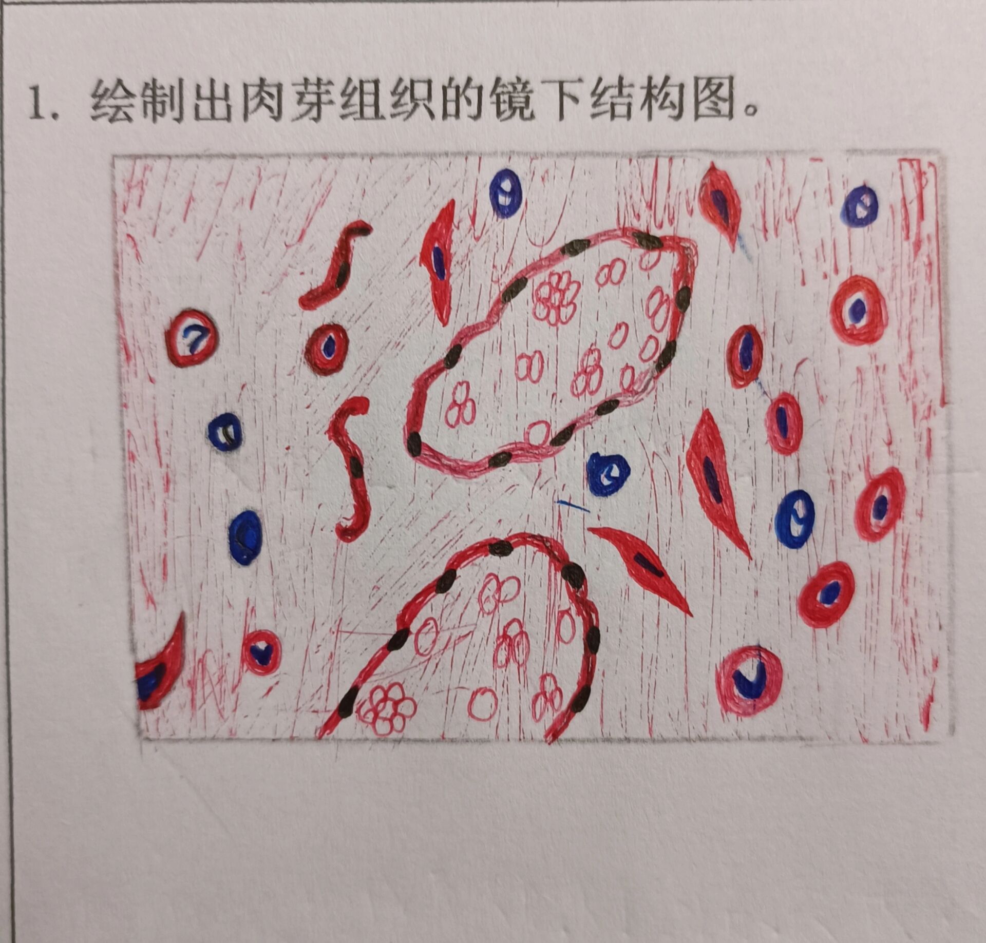 肉芽组织手绘图图片