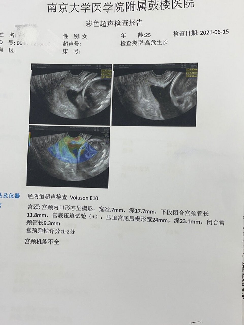 双子宫超声报告模板图片