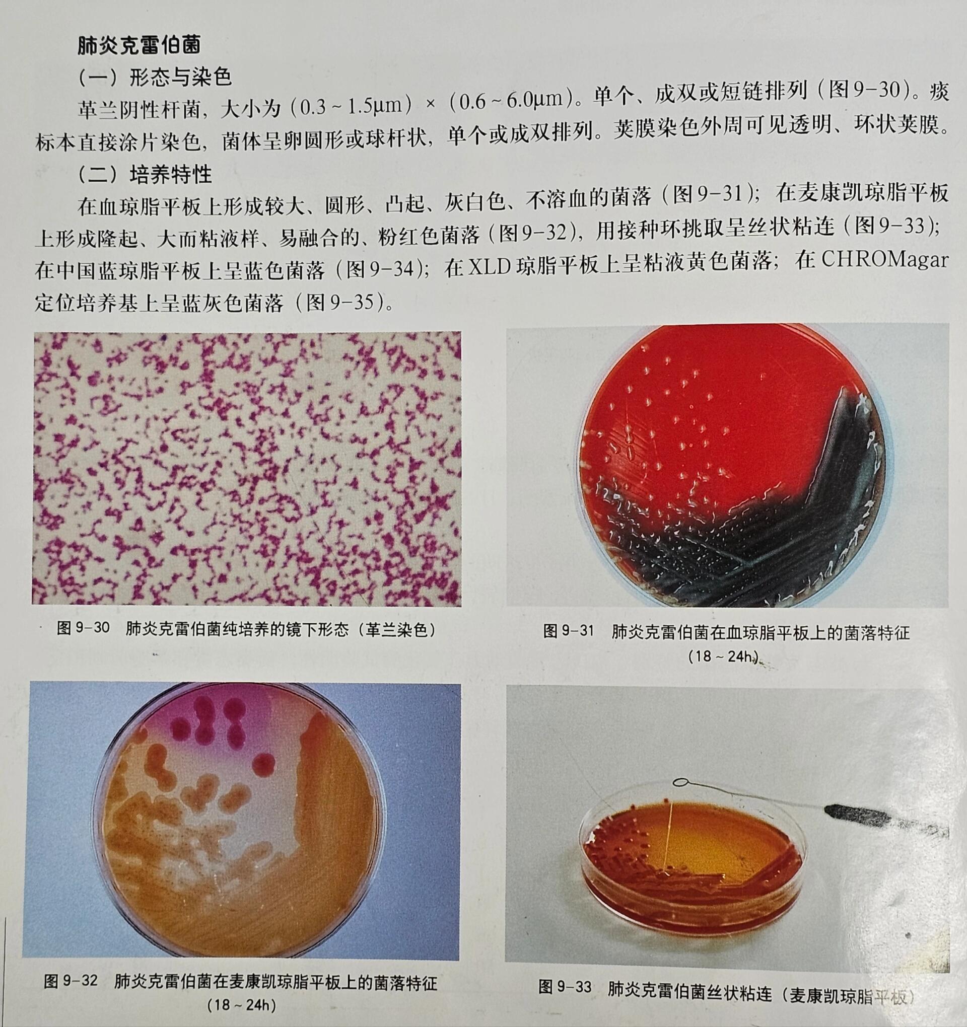 肺炎克雷伯菌的介绍 1形态与染色 2培养特性 3生化反应 4鉴别要点 5