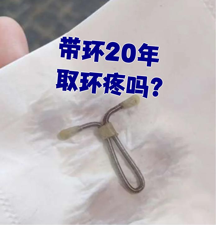 带尾丝的节育器取环时不用扩宫,直接用钳子夹住尾丝就能取出