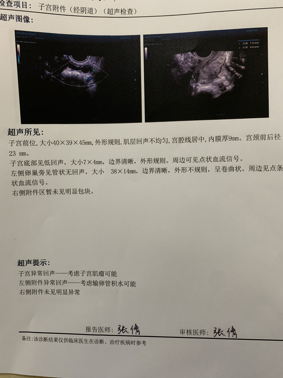 记录怀孕到宫腔重度粘连的治疗之路(4) 接上篇 在医院住了7天,去头去
