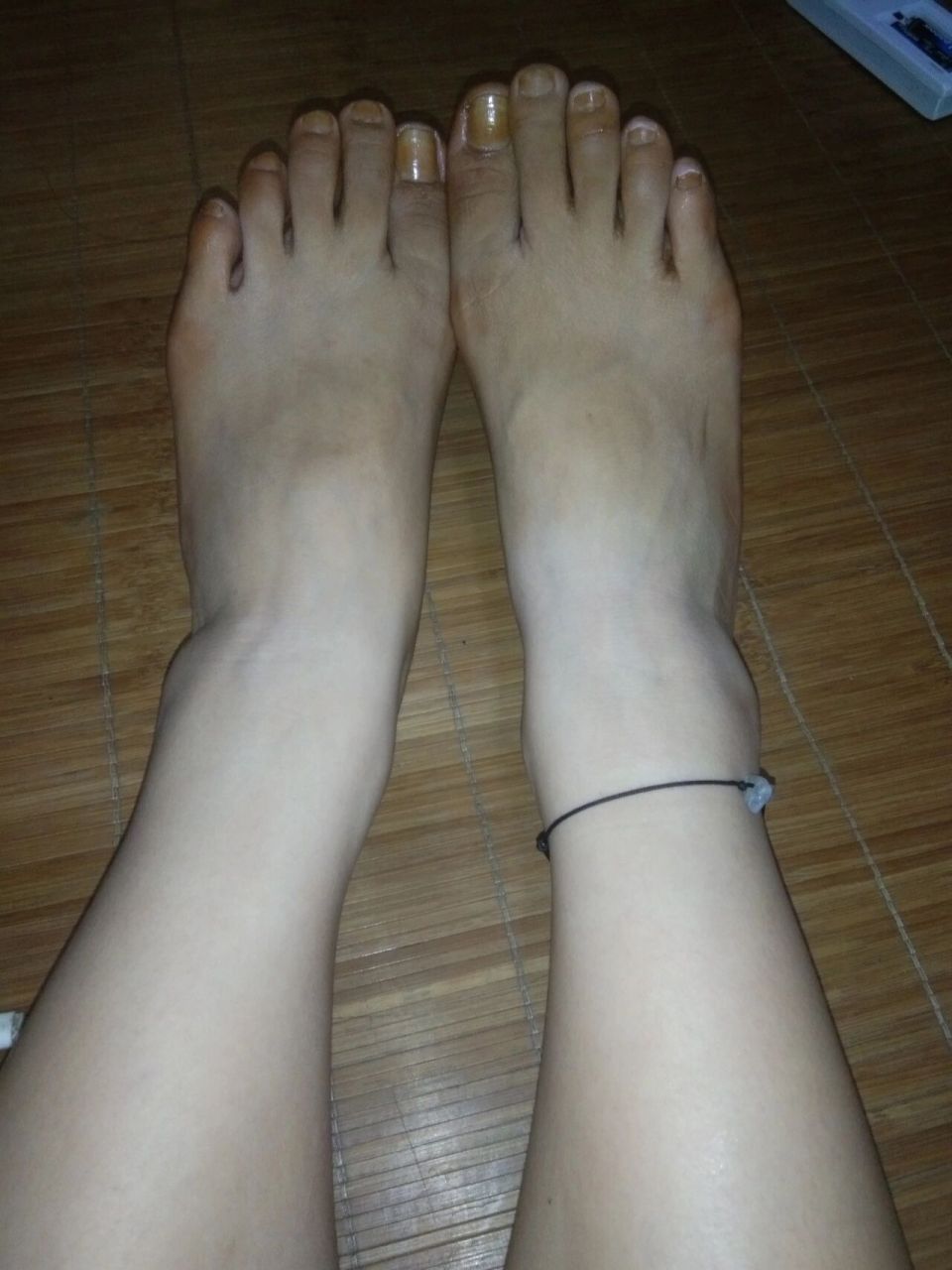 高锰酸钾泡脚,泡完后我感觉没泡到的地方白了一个度