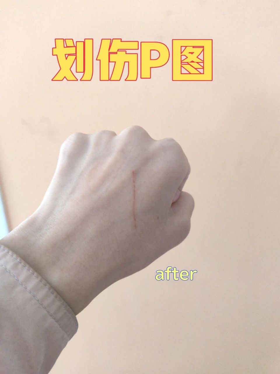 美图秀秀伤口p图简直太好用啦 只是浅浅用修容笔p了一下,如果想要更