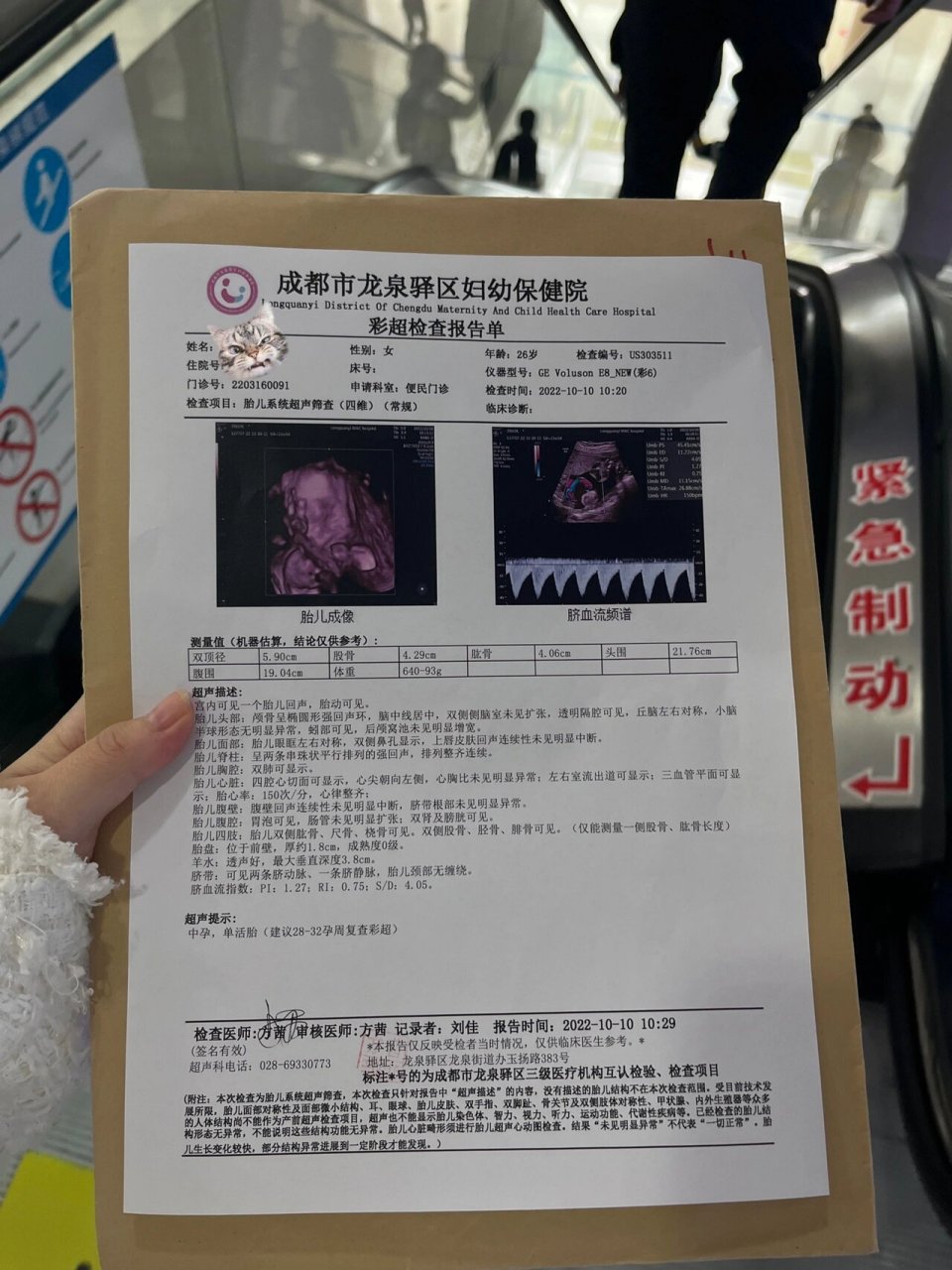 我当时拿到照片问了医生:我是怀了个奥特曼吗?怎么长这样?