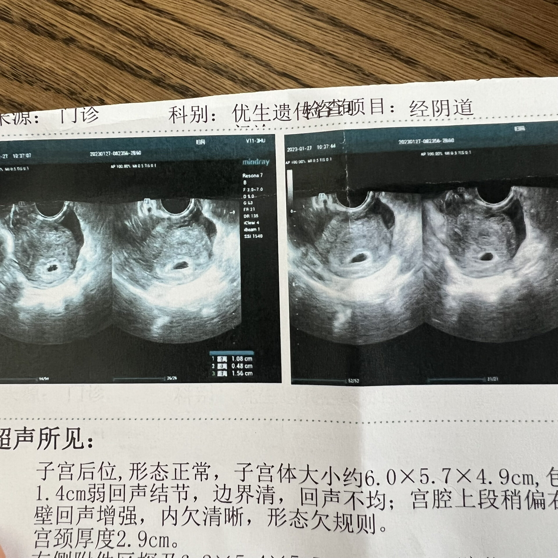 看到孕囊啦!