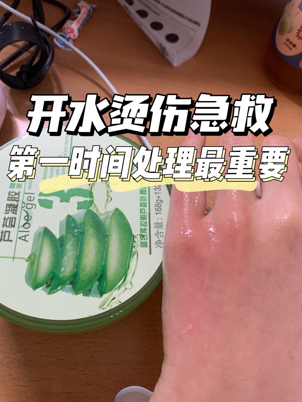 馃毃寮姘寸儷浼ゅ備綍鎬ユ晳 | 绗涓鏃堕棿澶勭悊鏈閲嶈侊紒 .