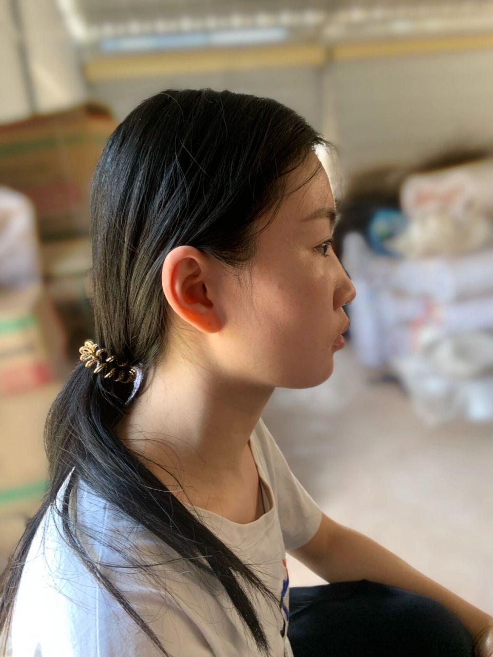 深覆合真的会导致脸方吗 牙齿深覆合是这样的吗,侧面拍起来那个咬肌那