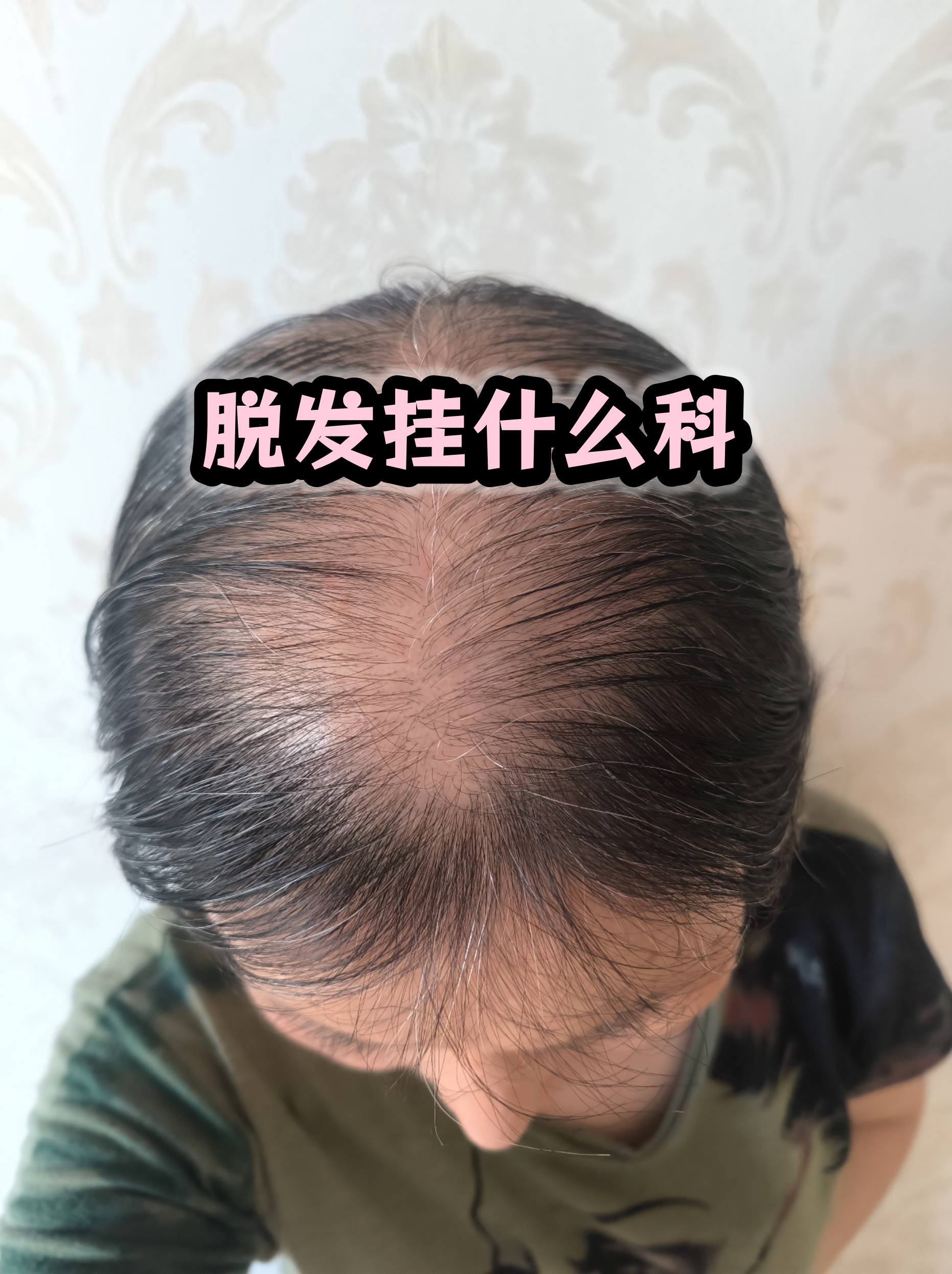 积水潭医院代挂专家号加代问诊及时解决你就医问题的简单介绍 积水潭医院代挂专家号加代问诊及时解决你就医问题的简单介绍