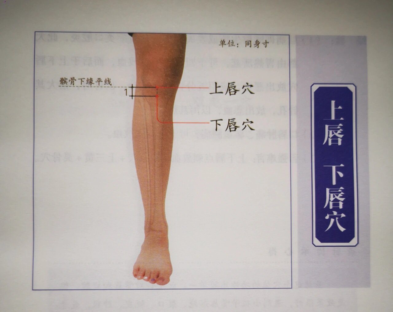 腿部针灸位置图图片