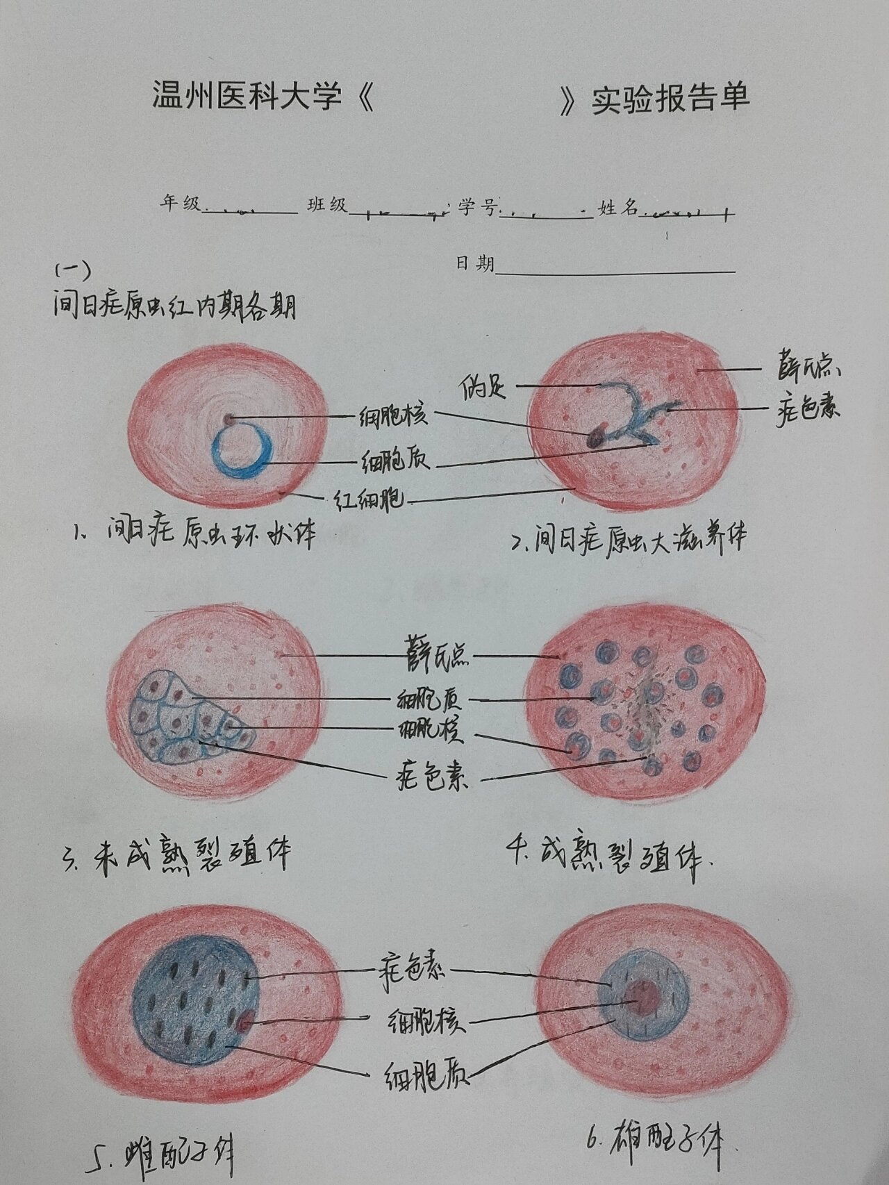 肝血吸虫病手绘图图片