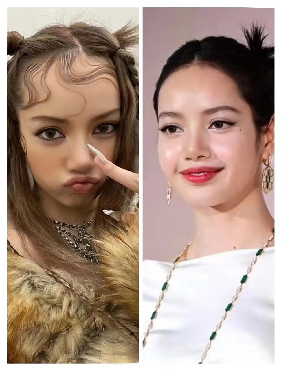 对比以前的发际线,lisa是不是植发了?