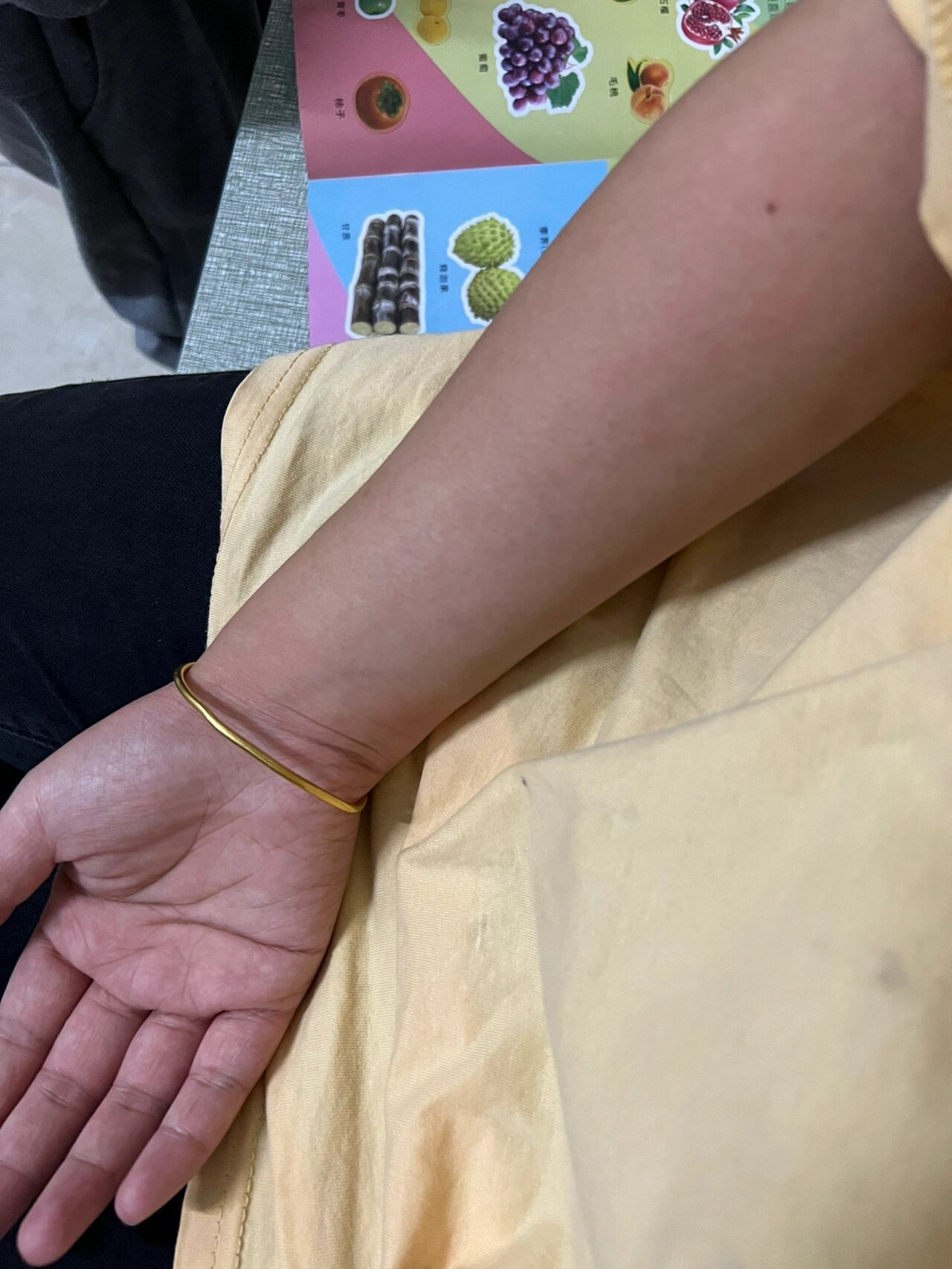 芋头过敏 就削了个芋头 就痒的不行了 恨不得剁手了要 涂了蚊虫止痒棒