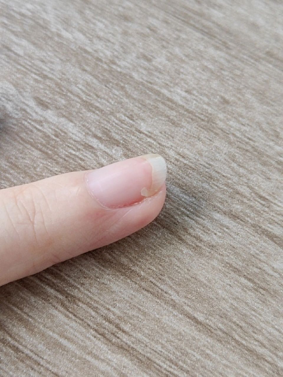 指甲有裂口去做美甲有用吗?