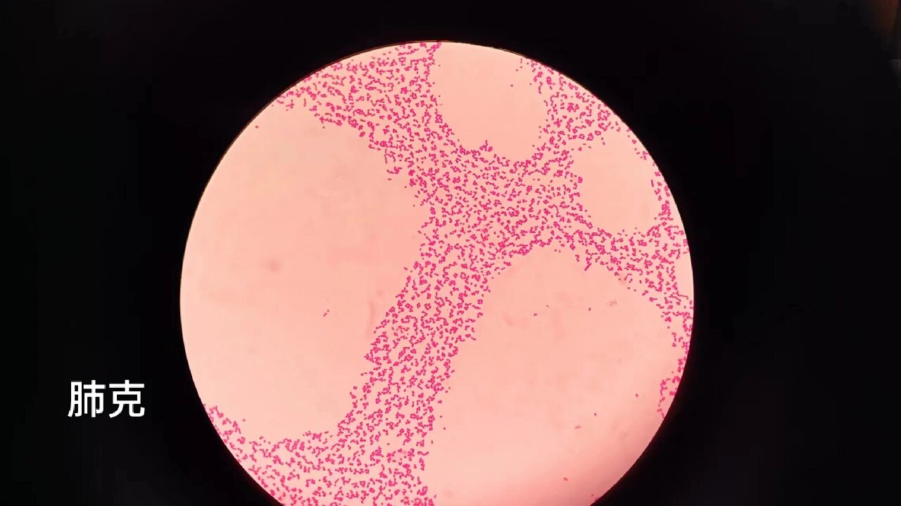 检验科常见细菌形态我帮你们看好了哦!
