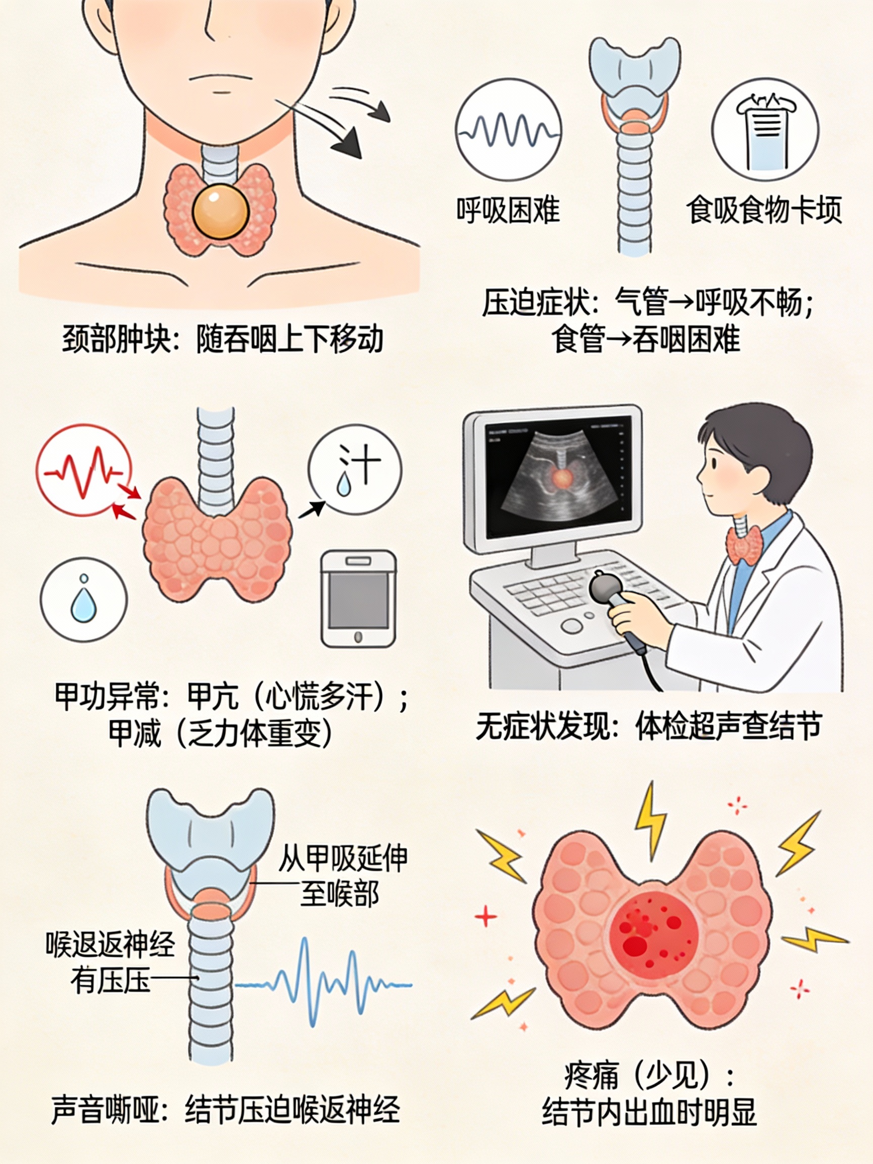 当结节较大时可能压迫气管导致呼吸不畅压迫食管引起吞咽困难