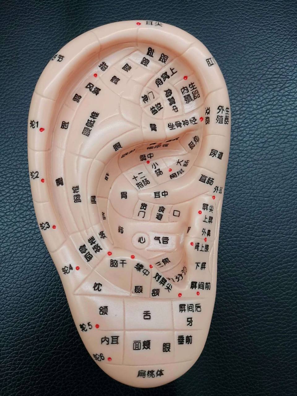 耳穴 压丸法: 神经衰弱: 先耳尖放血(放血量因人而异) 耳穴贴神门,肾