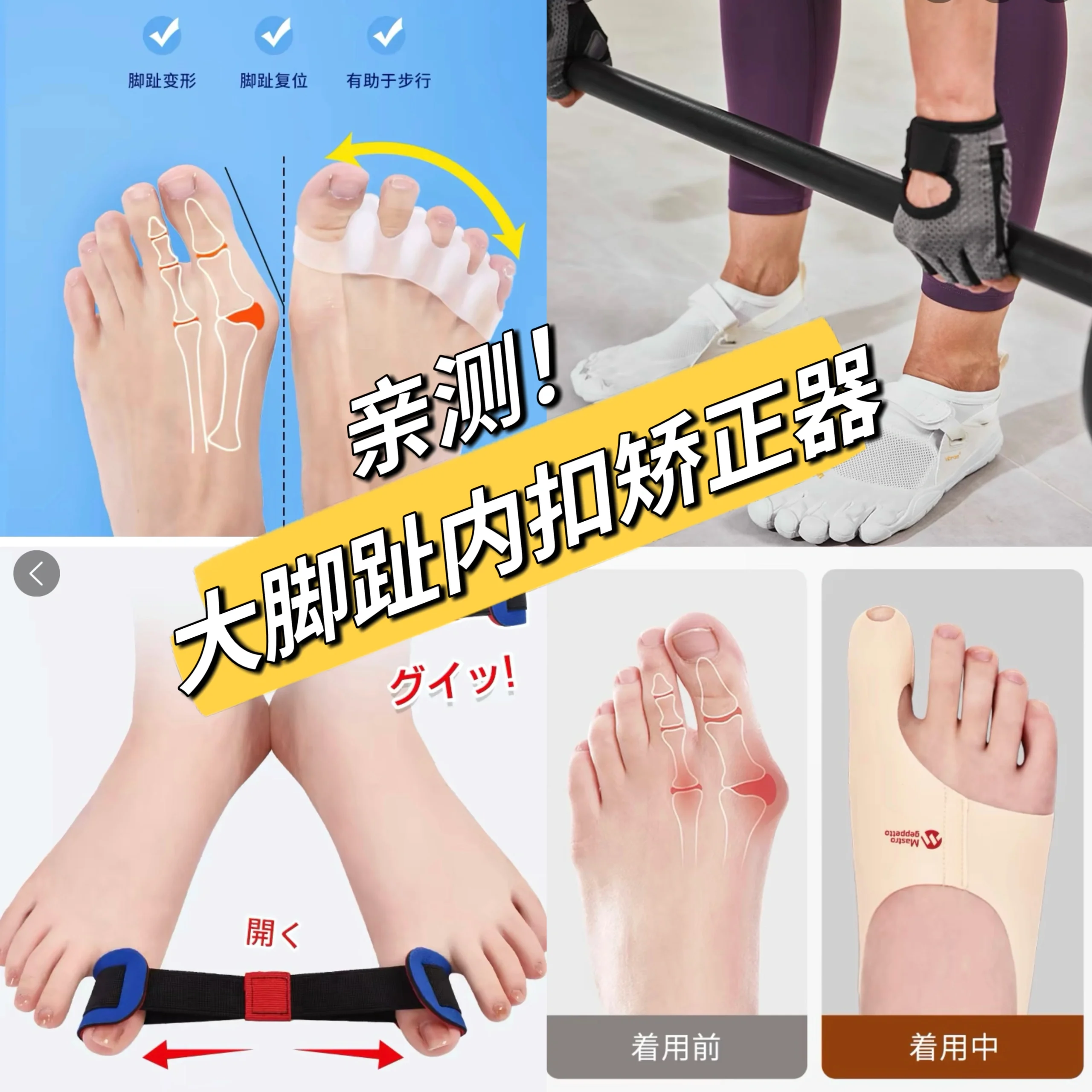 大脚趾内扣真的好难受啊01!