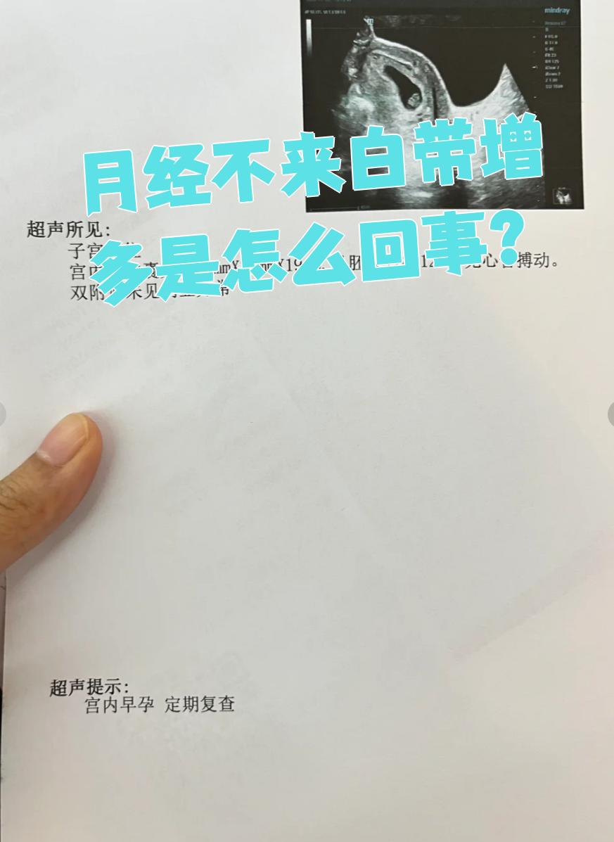 包含为什么白带多月经不来的词条