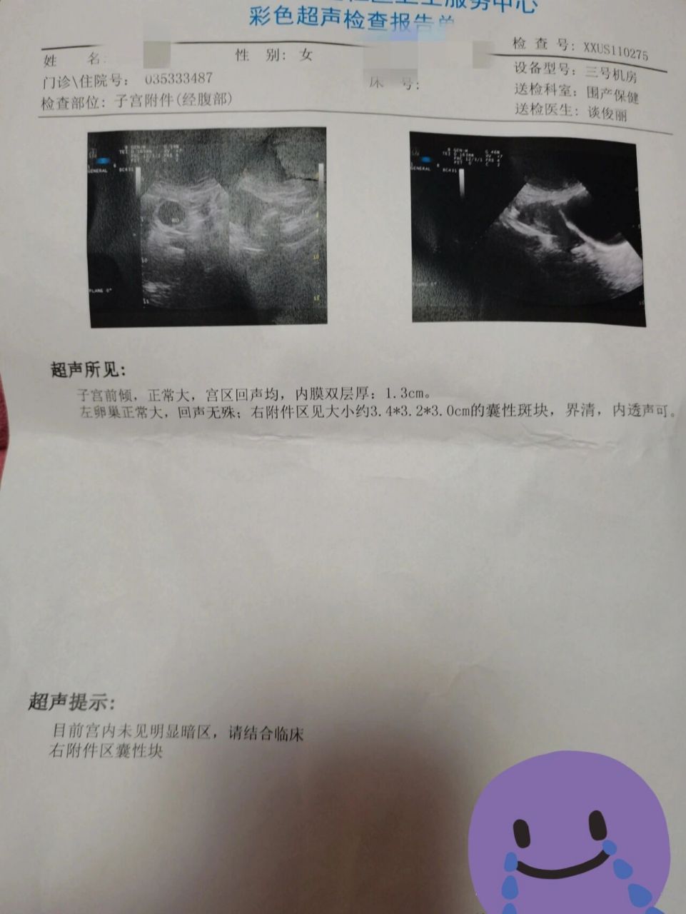 生化流血29天01010101 我是生化妊娠里流血最多的一个了吧