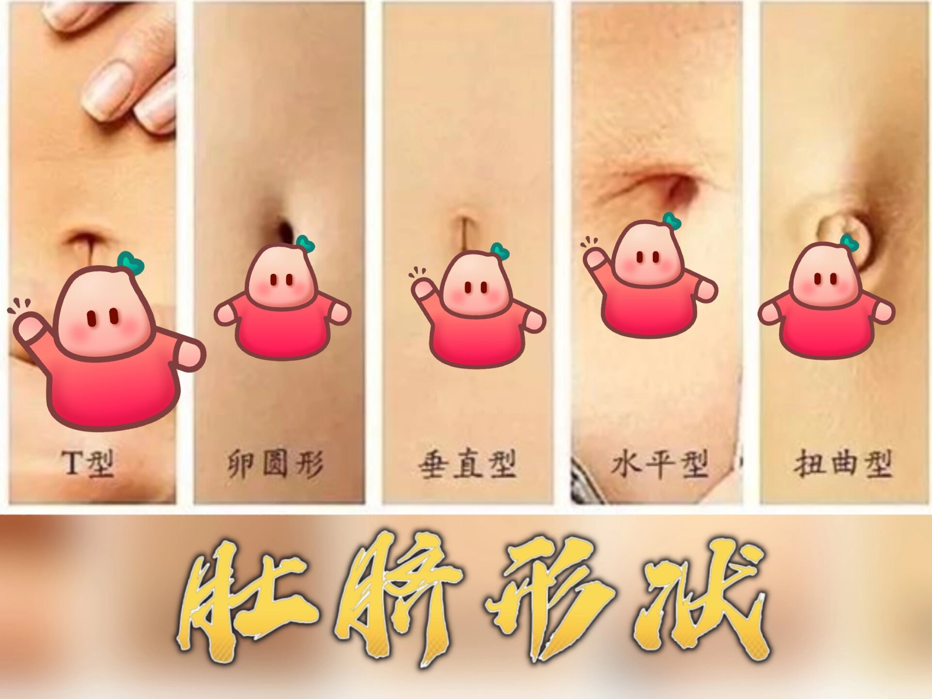 腹壁整形:这些肚脐形状有你喜欢的吗