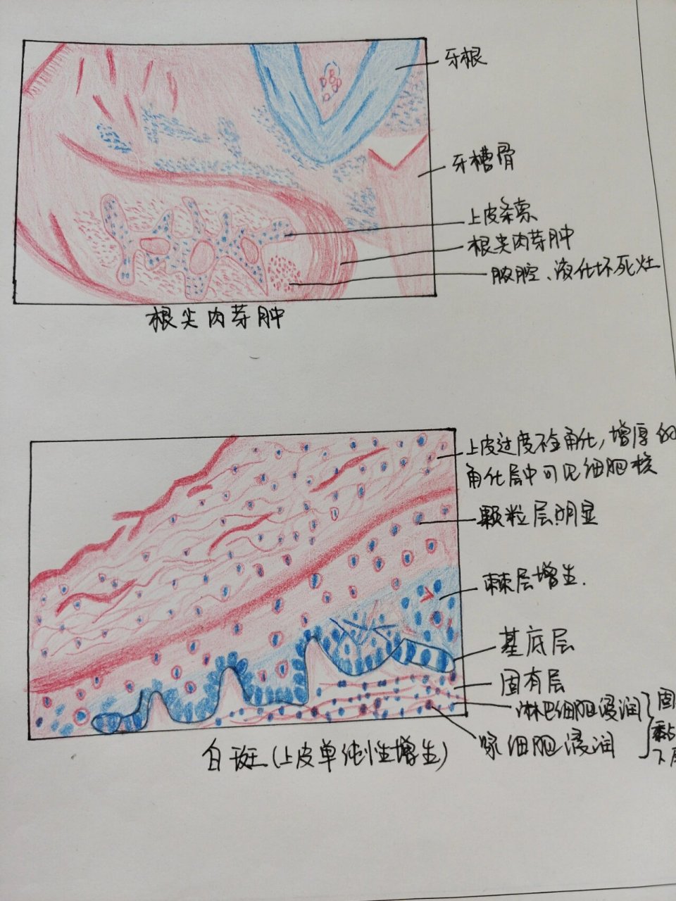 肉芽组织绘画图片