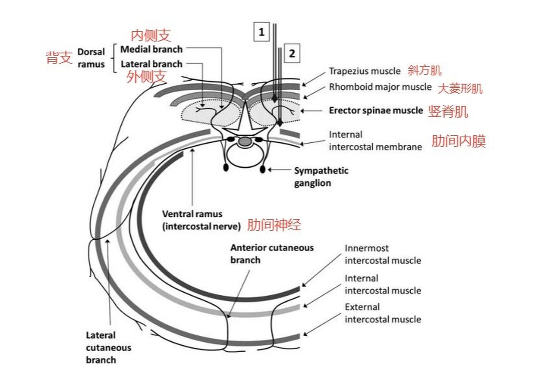麻醉笔记|超声引导下竖脊肌平面阻滞 竖脊肌群是一个广义,较难严格