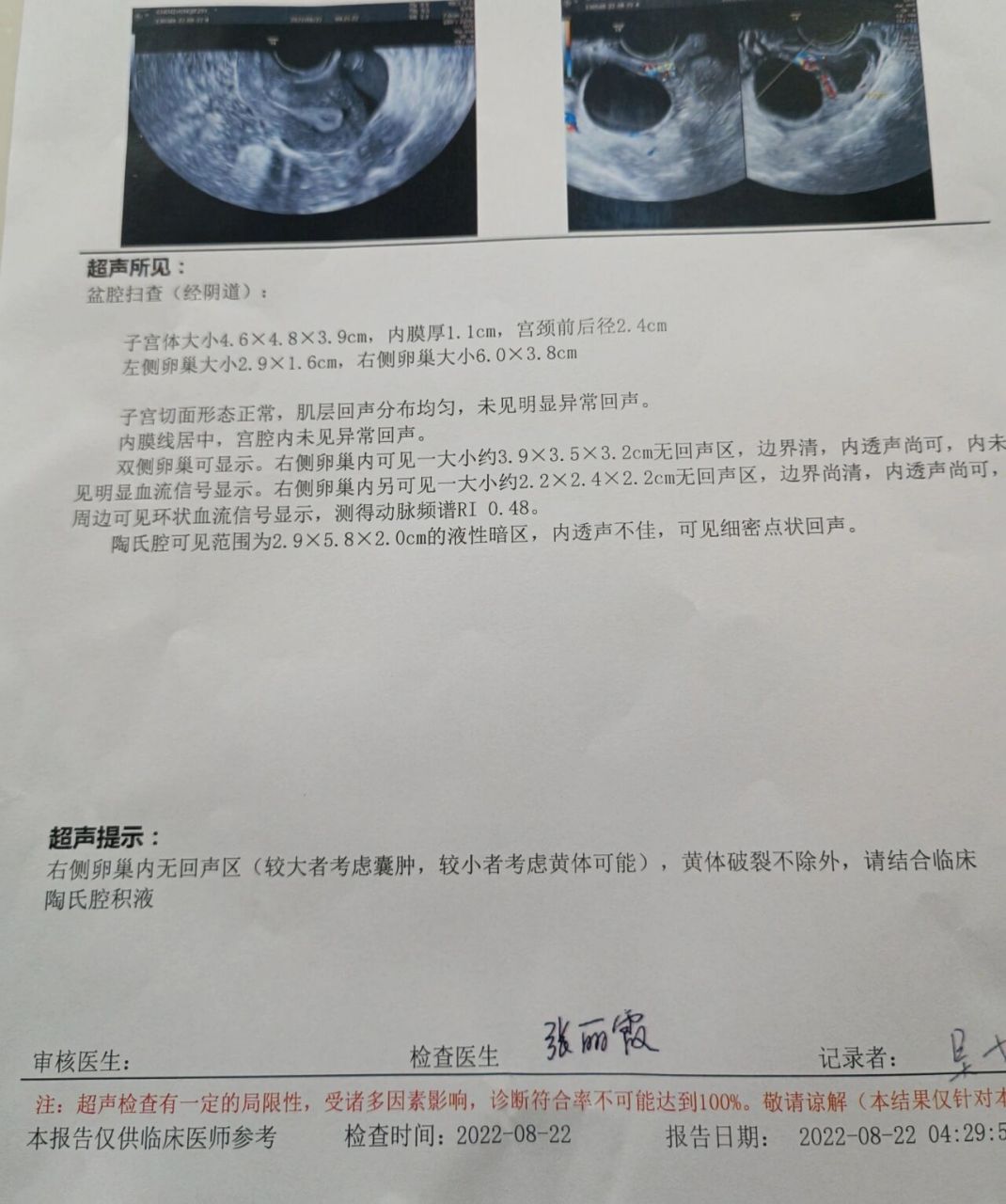黄体破裂大半夜急诊 看了一圈我的症状是最轻的 基本半个小时以后就