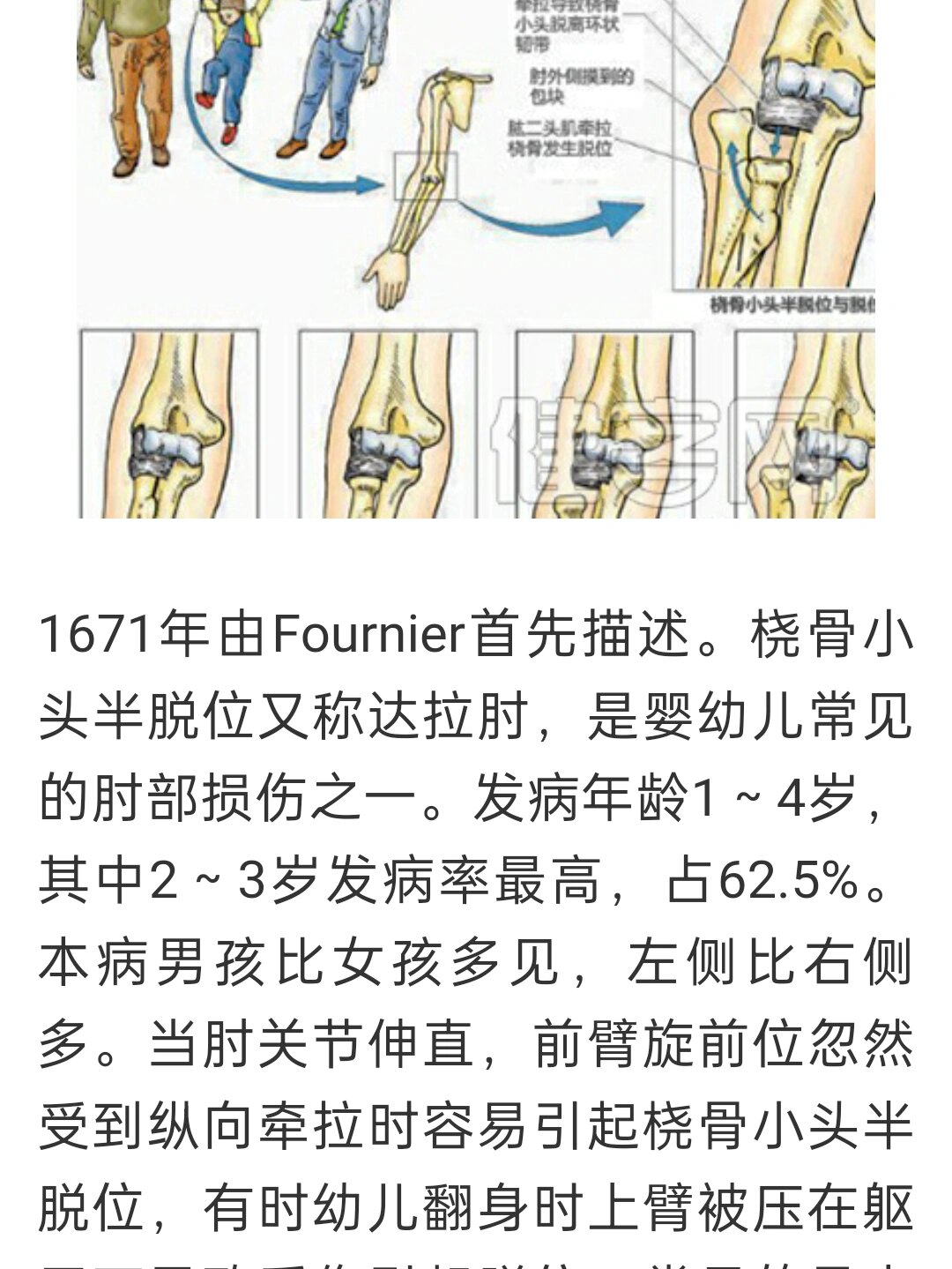 桡骨小头半图片