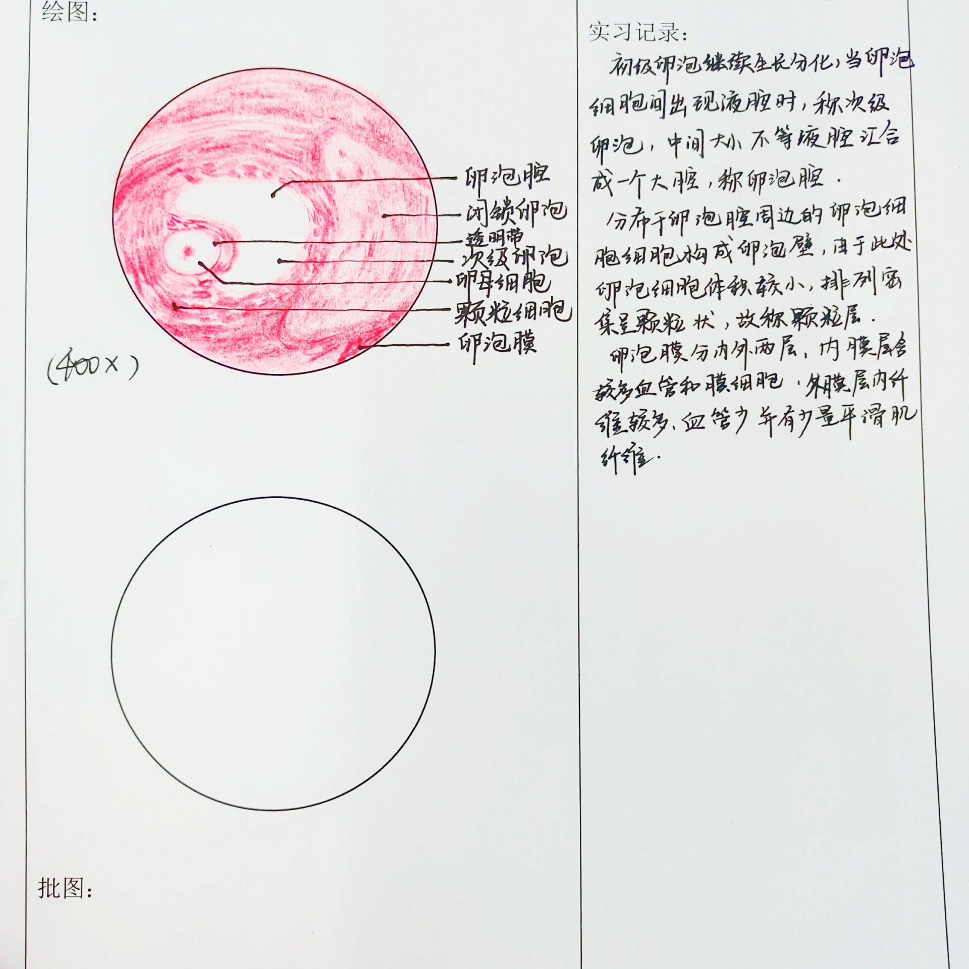 生殖系统 红蓝铅笔图 精子细胞 肌样细胞 睾丸间质细胞 精母细胞 支持