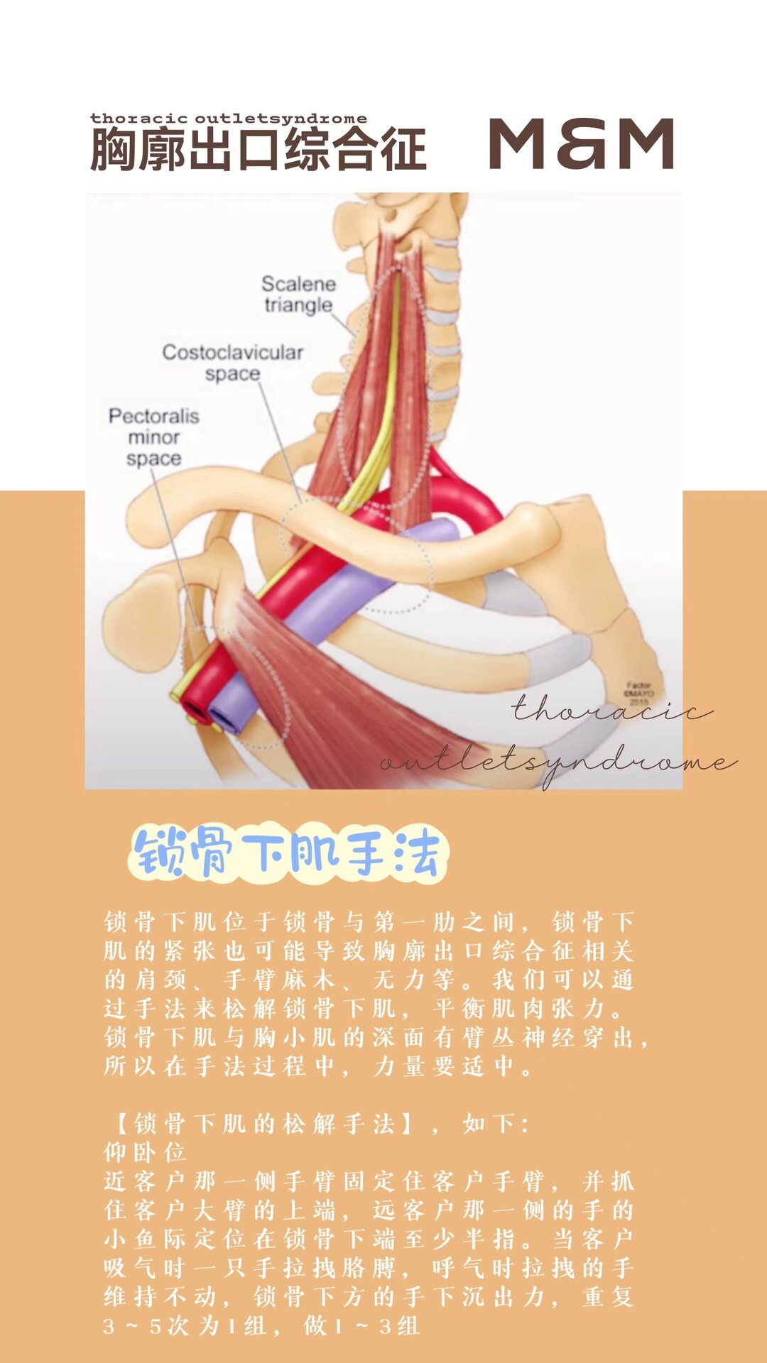 胸锁乳突肌松解手法图片