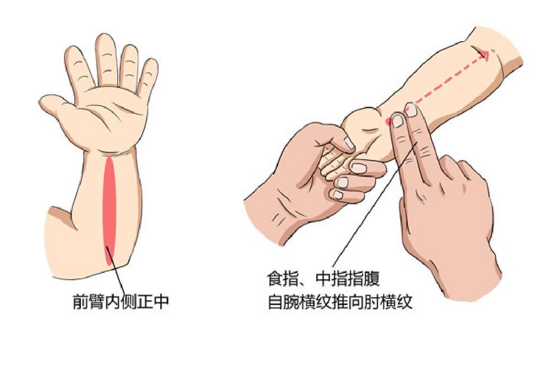 儿童退烧推拿 手法图片