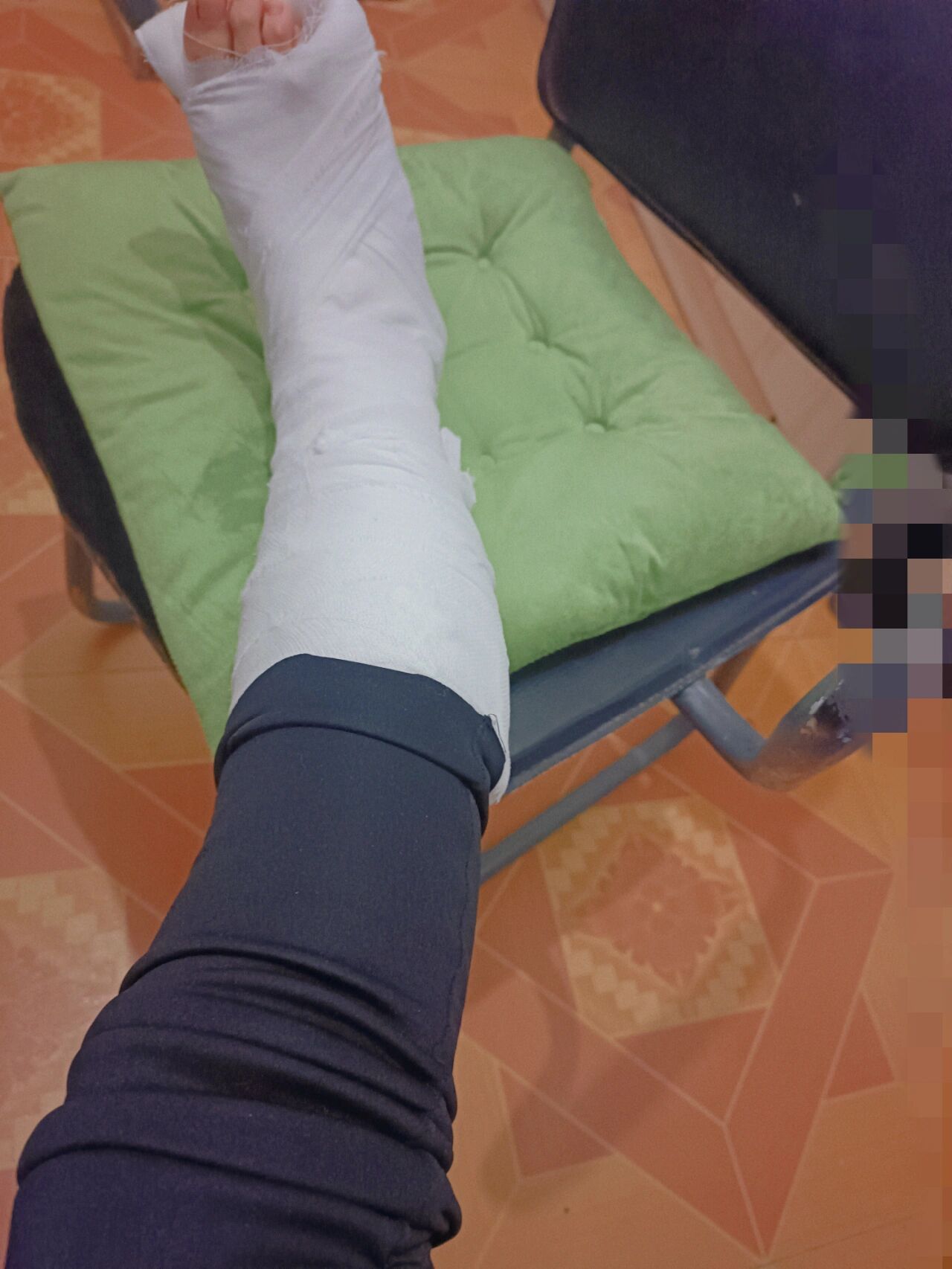 崴脚十八天后,打上了石膏没有比我再心大的吧.