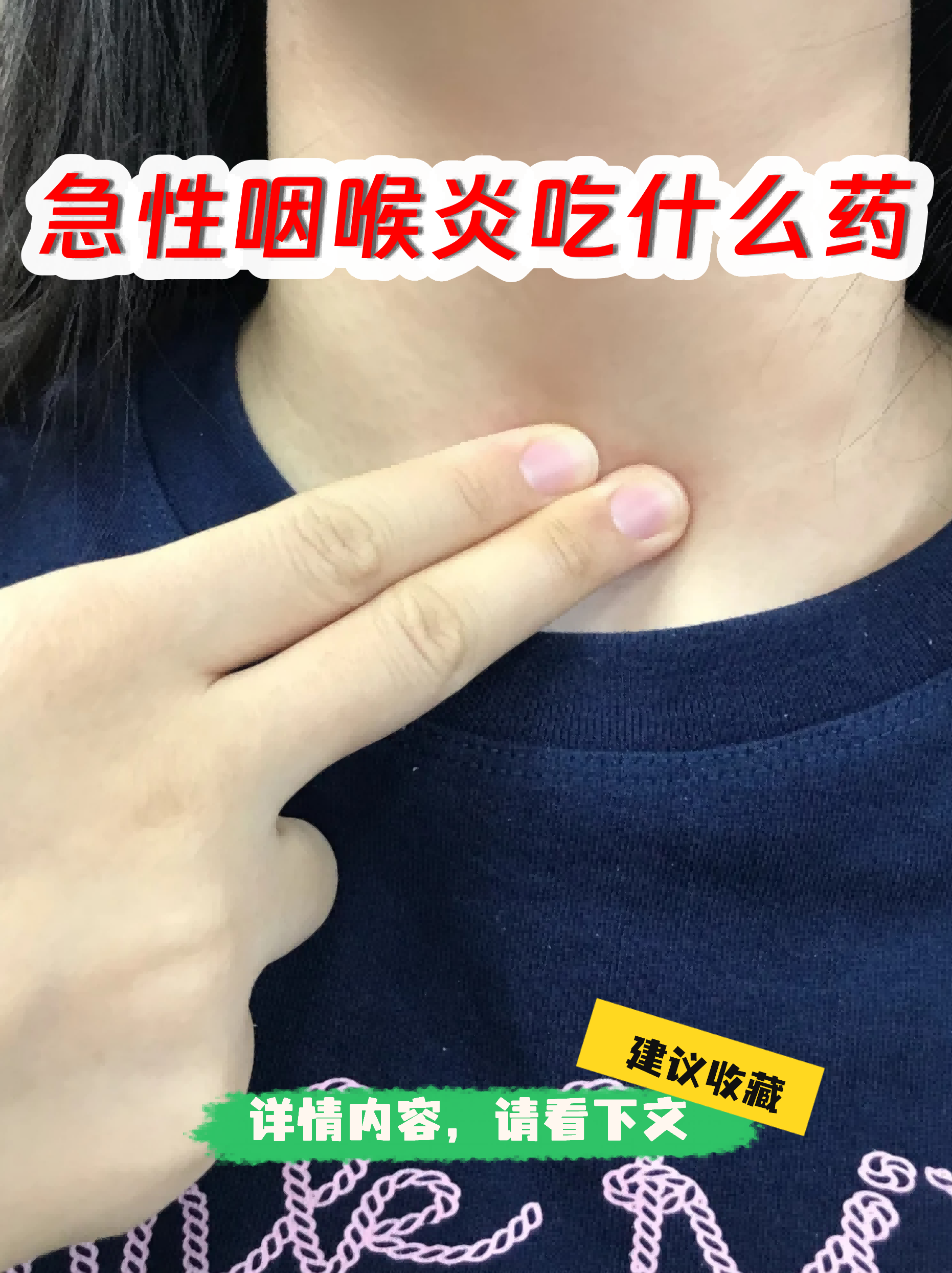  病毒引起喉咙痛吃什么药?(病毒引起的喉咙痛)