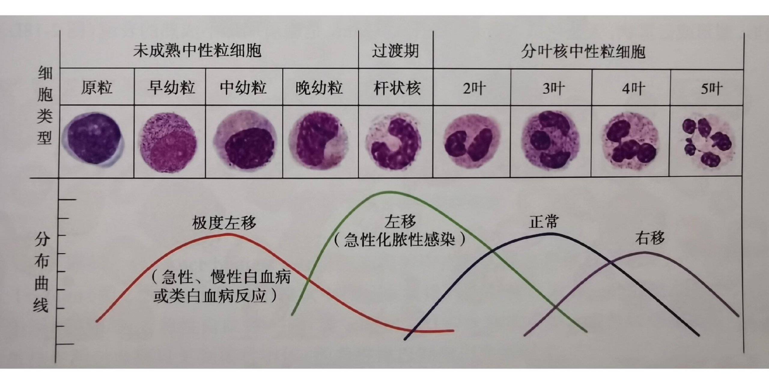 核左移图片