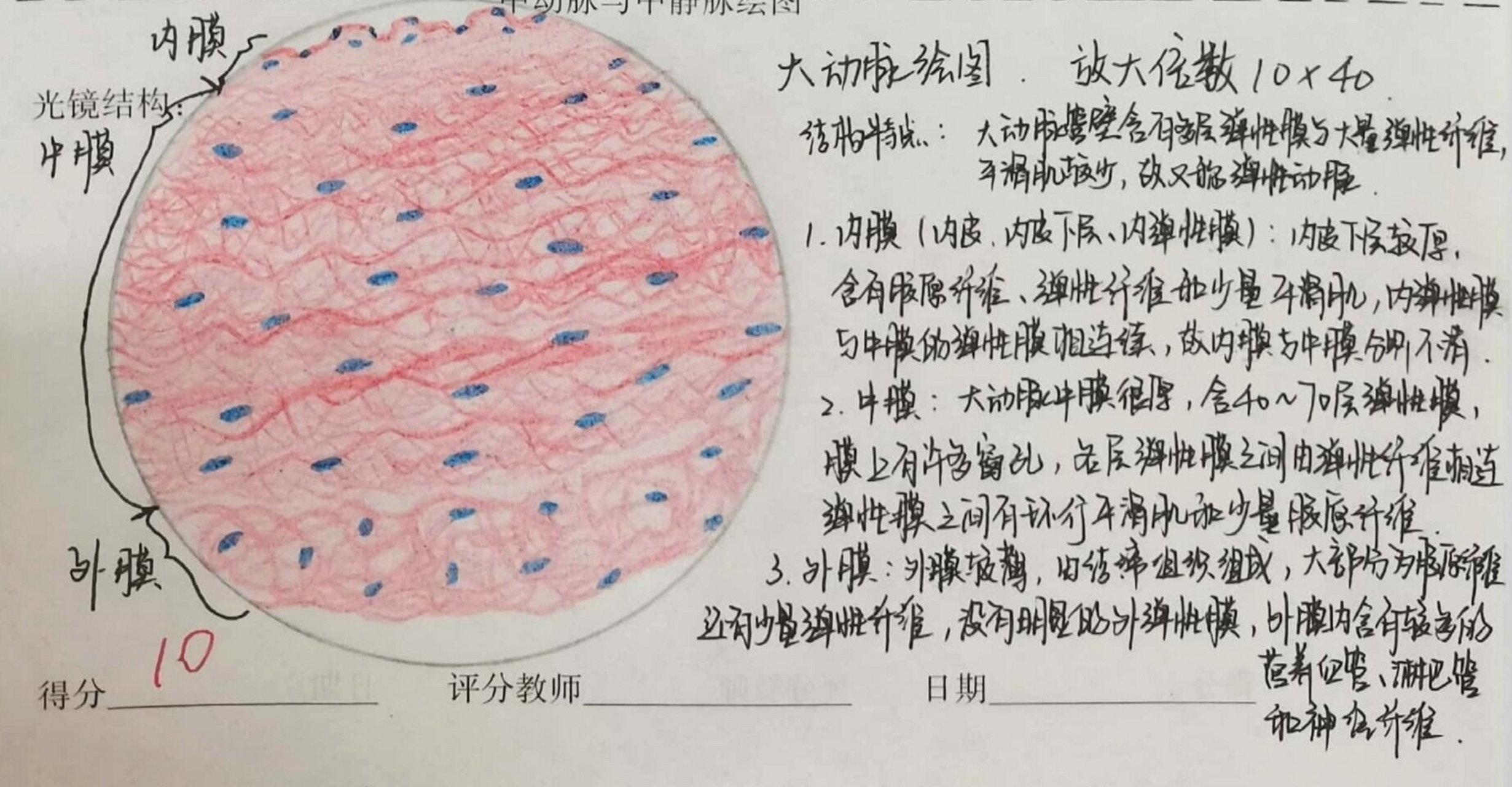 大动脉光镜图片