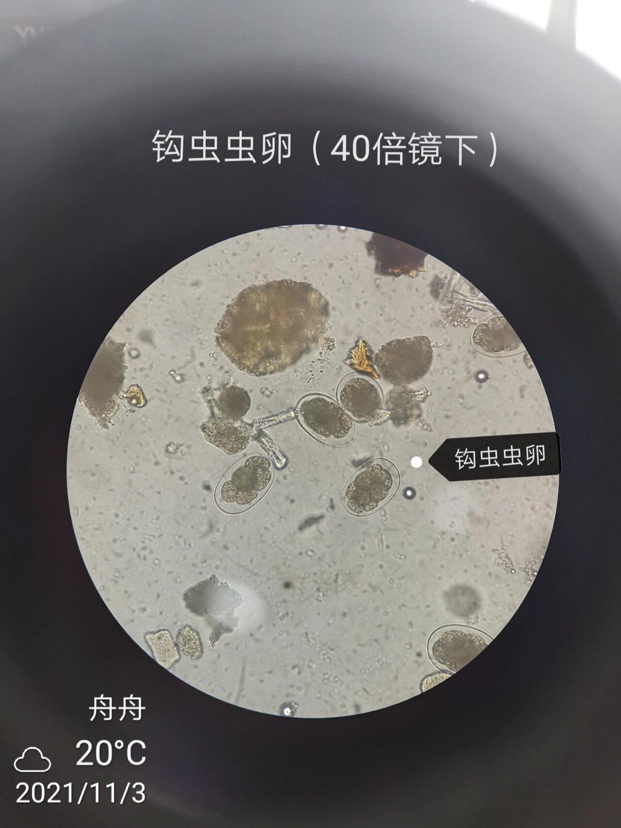 寄生虫笔记:线虫3—钩虫,旋毛虫