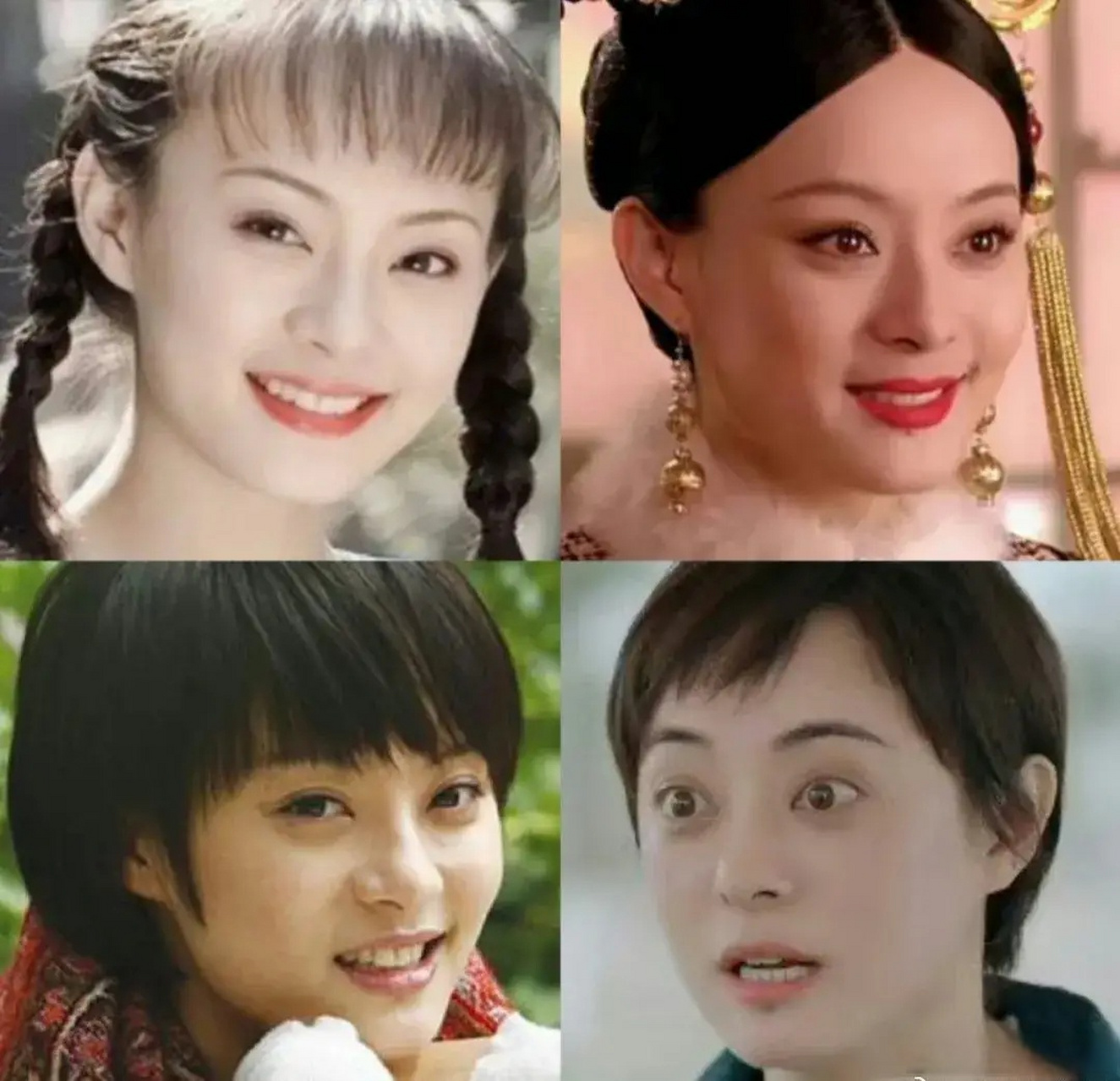 孙俪这几年眼睛为什么突出来了啊?是因为年纪上来了吗?