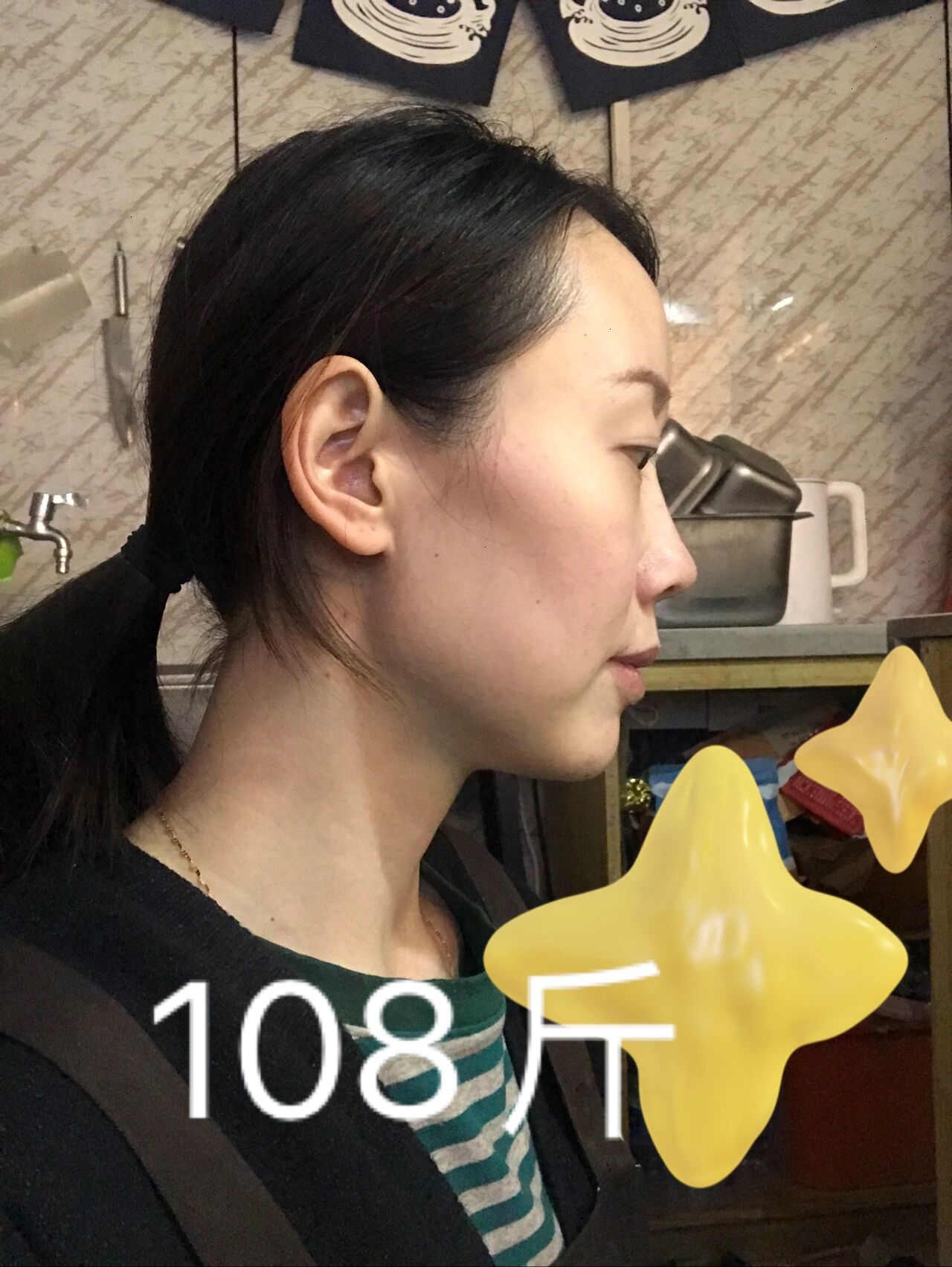 减肥20斤的侧脸变化大吗?