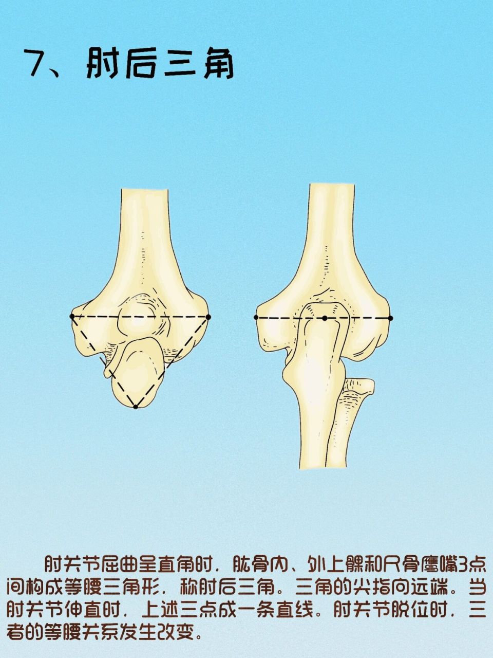 简介:肘关节由肱骨,尺骨与桡骨三者构成,是一个复