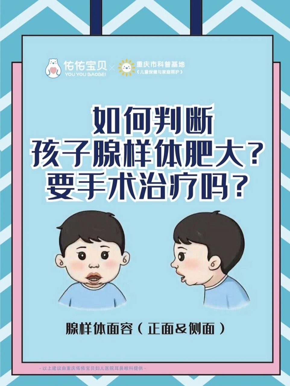 如何判斷孩子腺樣體肥大?要手術治療嗎? 96什麼是腺樣體面容?