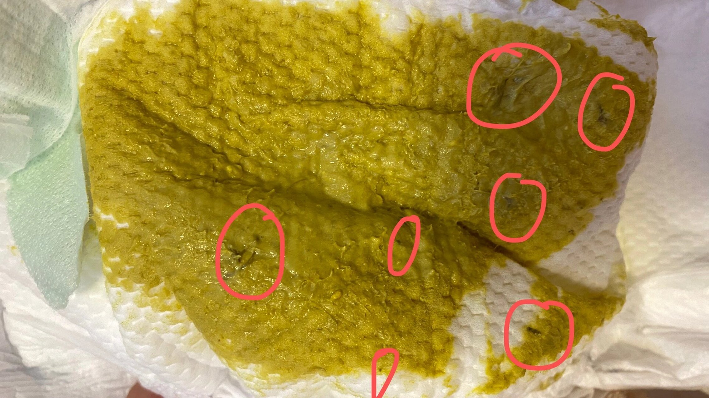 宝宝六个月突然拉黑色粘液 宝宝平时大便挺规律基本一天一次,黄色糊