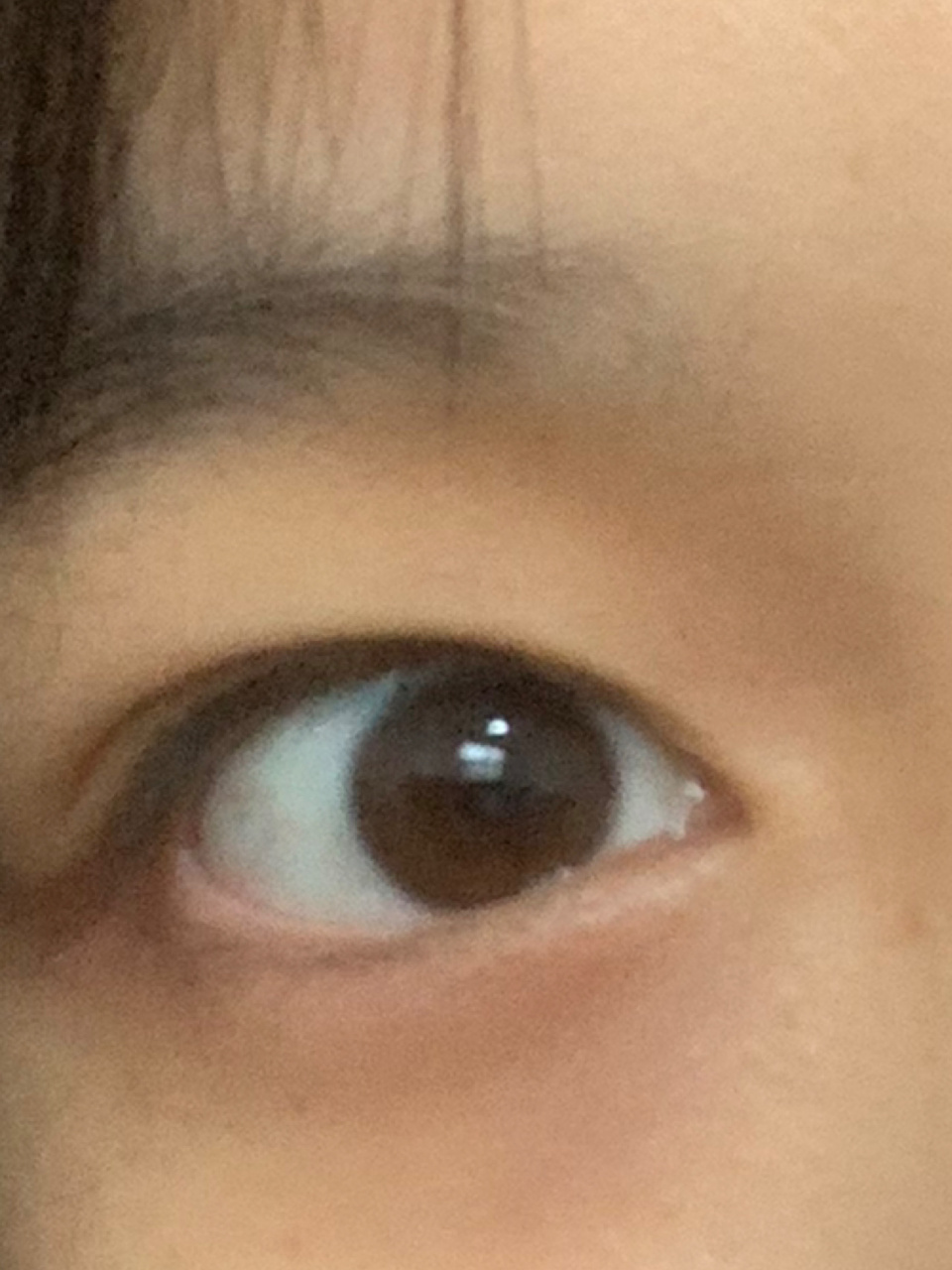 眼白发青啊啊 啊啊啊啊各位小红书的姐姐妹妹 有没有觉得我这个眼白