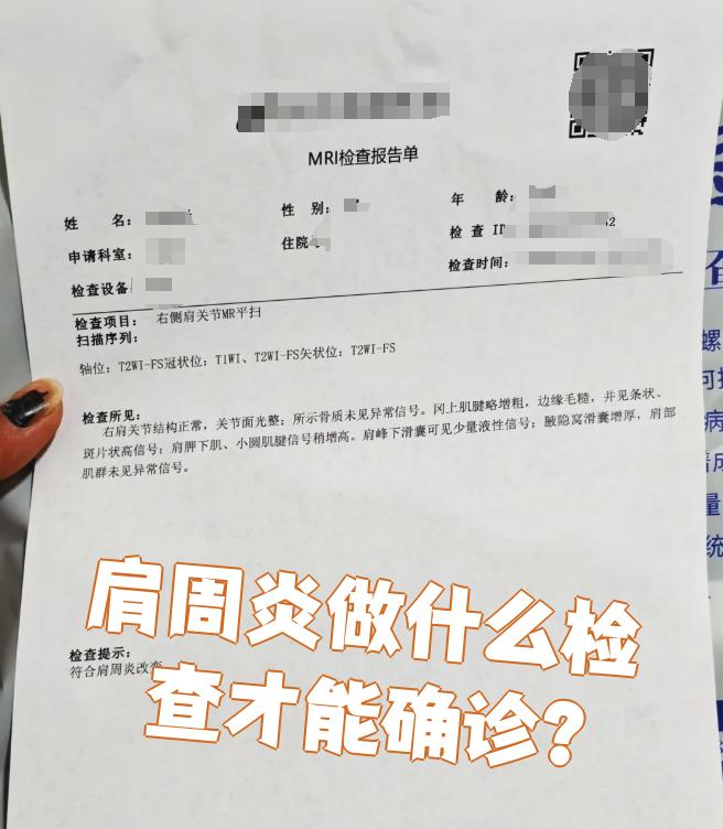 要确诊肩周炎,通常需要做以下检查: