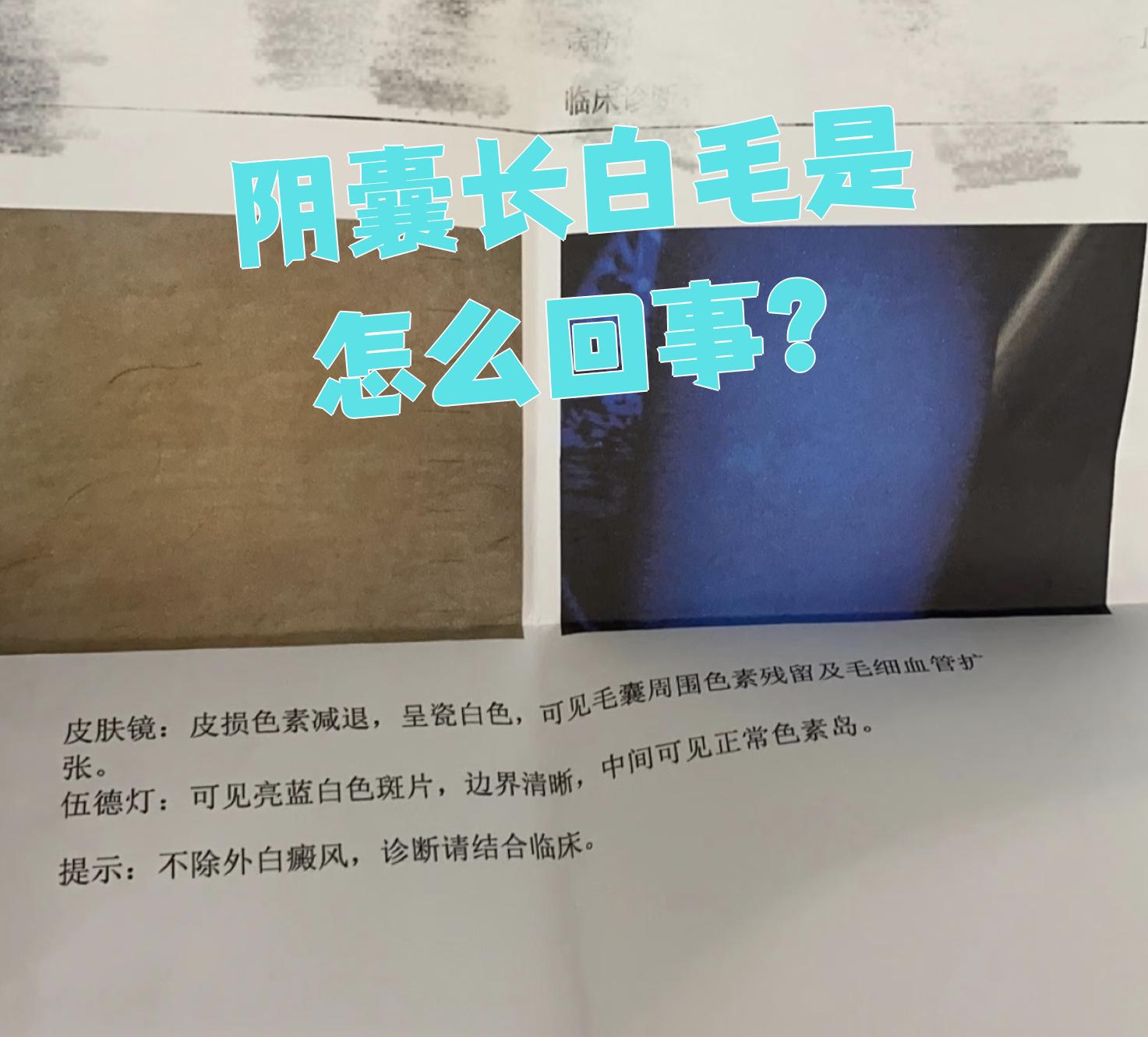 40岁私下长了几根白毛为什么